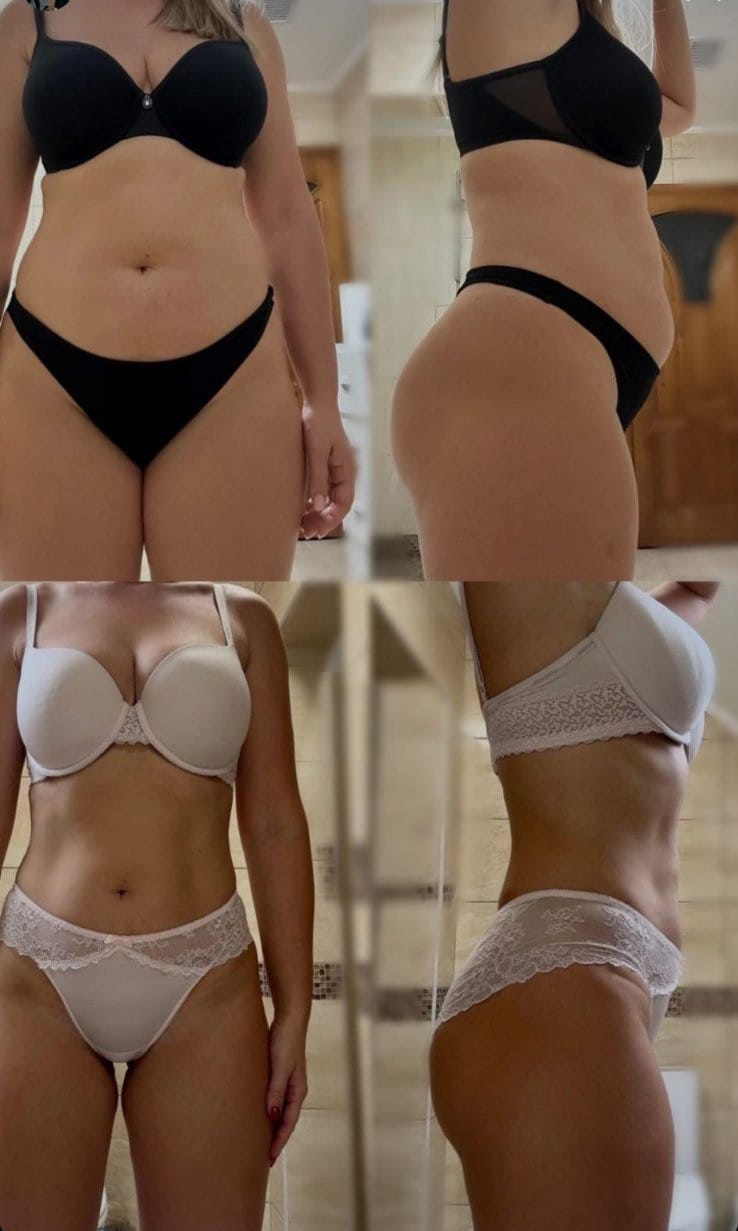 Client transformation